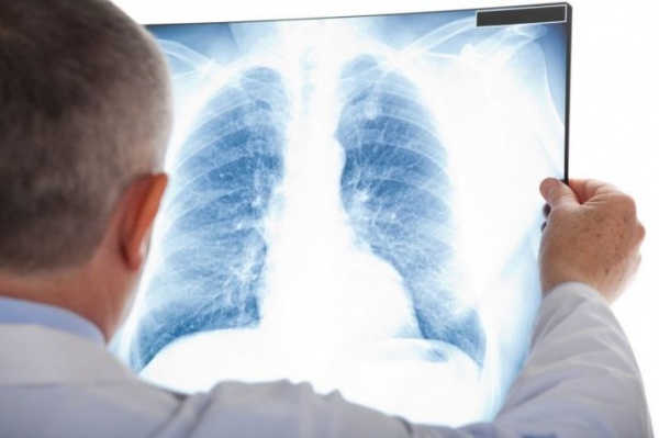 Новый рентген-аппарат появится в Воскресенской областной больнице