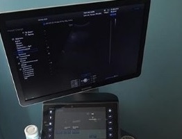 Коломенская ЦРБ получила новый ультразвуковой сканер